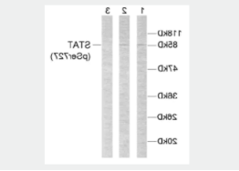 Anti-STAT3 (phospho S727)抗体.png Anti-STAT3 (phospho S727)抗体.png